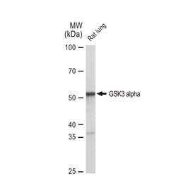 Anti-GSK3 alpha antibody [GT1264] used in Western Blot (WB). GTX02861