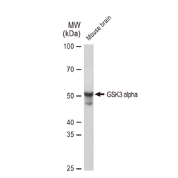Anti-GSK3 alpha antibody [GT1264] used in Western Blot (WB). GTX02861