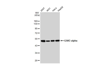 Anti-GSK3 alpha antibody [GT1264] used in Western Blot (WB). GTX02861