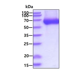Human LBP protein, His tag. GTX02867-pro