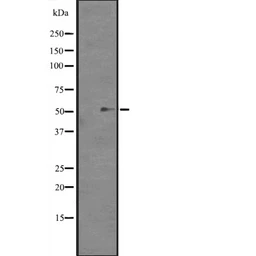 Anti-PAX1 antibody used in Western Blot (WB). GTX02870