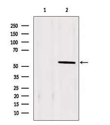 Anti-PAX1 antibody used in Western Blot (WB). GTX02870