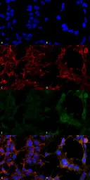 Anti-Hexanoyl-Lysine adduct antibody [5D9] used in Immunocytochemistry/ Immunofluorescence (ICC/IF). GTX02872