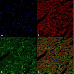 Anti-Hexanoyl-Lysine adduct antibody [5D9] used in IHC (Paraffin sections) (IHC-P). GTX02872