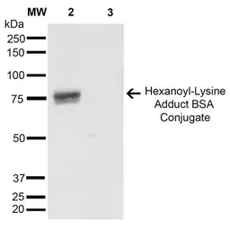 Anti-Hexanoyl-Lysine adduct antibody [5D9] used in Western Blot (WB). GTX02872