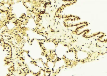 Anti-NRF2 (phospho Ser40) antibody used in IHC (Paraffin sections) (IHC-P). GTX02873