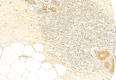 Anti-NRF2 (phospho Ser40) antibody used in IHC (Paraffin sections) (IHC-P). GTX02873