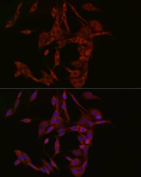 Anti-C6ORF150 antibody used in Immunocytochemistry/ Immunofluorescence (ICC/IF). GTX02874