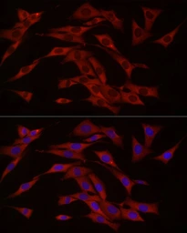 Anti-C6ORF150 antibody used in Immunocytochemistry/ Immunofluorescence (ICC/IF). GTX02874