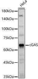 Anti-C6ORF150 antibody used in Western Blot (WB). GTX02874