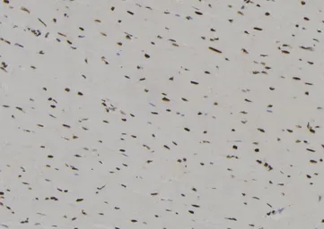 Anti-IRF3 (phospho Ser396) antibody used in IHC (Paraffin sections) (IHC-P). GTX02883