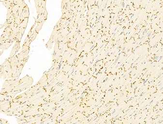 Anti-IRF3 (phospho Ser396) antibody used in IHC (Paraffin sections) (IHC-P). GTX02883