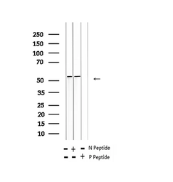 Anti-IRF3 (phospho Ser396) antibody used in Western Blot (WB). GTX02883