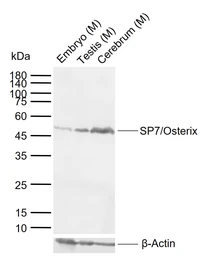 Anti-SP7 antibody used in Western Blot (WB). GTX02884