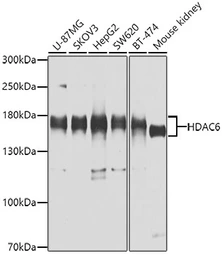 Anti-HDAC6 antibody used in Western Blot (WB). GTX02885