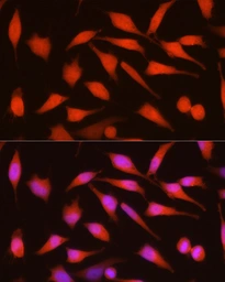 Anti-CDKN2A / p16INK4a antibody used in Immunocytochemistry/ Immunofluorescence (ICC/IF). GTX03119