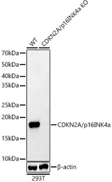 Anti-CDKN2A / p16INK4a antibody used in Western Blot (WB). GTX03119
