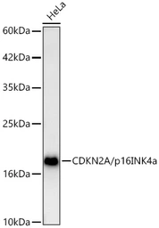 Anti-CDKN2A / p16INK4a antibody used in Western Blot (WB). GTX03119
