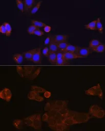 Anti-CES1 antibody [GT1271] used in Immunocytochemistry/ Immunofluorescence (ICC/IF). GTX03183