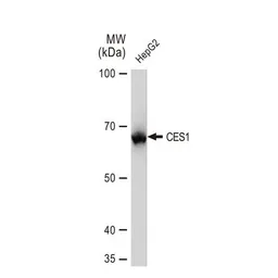 Anti-CES1 antibody [GT1271] used in Western Blot (WB). GTX03183