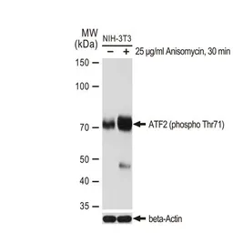 Anti-ATF2 (phospho Thr71) antibody [GT1275] used in Western Blot (WB). GTX03187