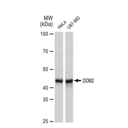 Anti-DDB2 antibody [GT1277] used in Western Blot (WB). GTX03189
