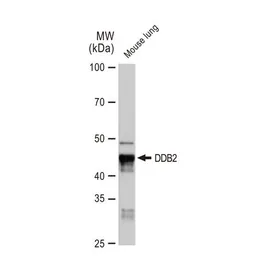 Anti-DDB2 antibody [GT1277] used in Western Blot (WB). GTX03189