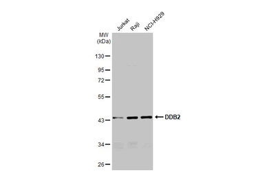 Anti-DDB2 antibody [GT1277] used in Western Blot (WB). GTX03189