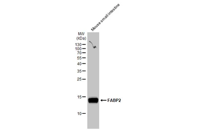 Anti-FABP2 antibody [GT1280] used in Western Blot (WB). GTX03192