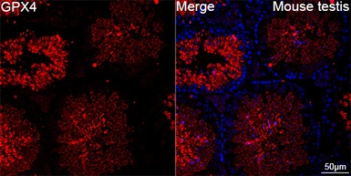Anti-GPX4 antibody [GT1282] used in IHC (Paraffin sections) (IHC-P). GTX03194