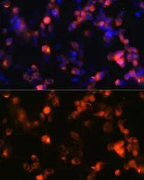 Anti-GluR2 antibody [GT1283] used in Immunocytochemistry/ Immunofluorescence (ICC/IF). GTX03195