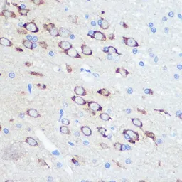 Anti-GluR2 antibody [GT1283] used in IHC (Paraffin sections) (IHC-P). GTX03195