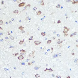 Anti-GluR2 antibody [GT1283] used in IHC (Paraffin sections) (IHC-P). GTX03195