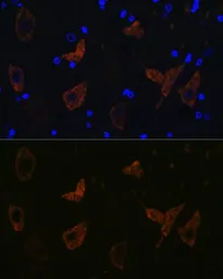 Anti-GluR2 antibody [GT1283] used in IHC (Paraffin sections) (IHC-P). GTX03195