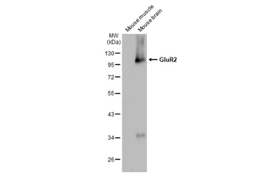 Anti-GluR2 antibody [GT1283] used in Western Blot (WB). GTX03195