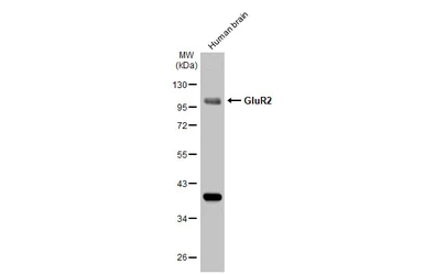 Anti-GluR2 antibody [GT1283] used in Western Blot (WB). GTX03195