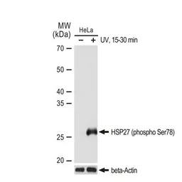 Anti-HSP27 (phospho Ser78) antibody [GT1285] used in Western Blot (WB). GTX03197
