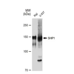 Anti-SHIP1 antibody [GT1287] used in Western Blot (WB). GTX03199