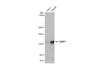 Anti-SHIP1 antibody [GT1287] used in Western Blot (WB). GTX03199