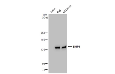 Anti-SHIP1 antibody [GT1287] used in Western Blot (WB). GTX03199