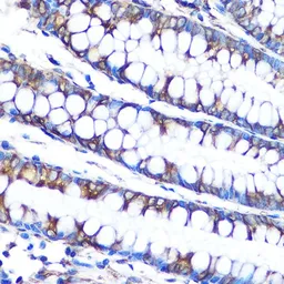 Anti-LOX antibody [GT1289] used in IHC (Paraffin sections) (IHC-P). GTX03201