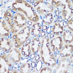 Anti-LOX antibody [GT1289] used in IHC (Paraffin sections) (IHC-P). GTX03201