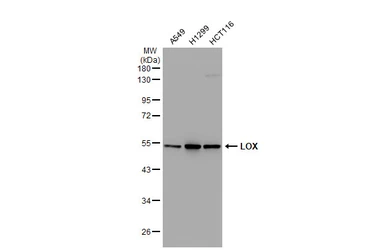 Anti-LOX antibody [GT1289] used in Western Blot (WB). GTX03201