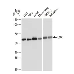 Anti-LOX antibody [GT1289] used in Western Blot (WB). GTX03201