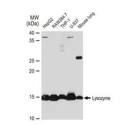 Anti-Lysozyme antibody [GT1290] used in Western Blot (WB). GTX03202