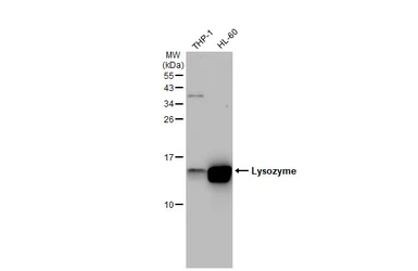 Anti-Lysozyme antibody [GT1290] used in Western Blot (WB). GTX03202