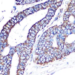 Anti-MTCO2 antibody [GT1293] used in IHC (Paraffin sections) (IHC-P). GTX03205