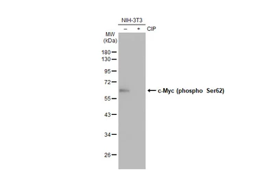 Anti-c-Myc (phospho Ser62) antibody [GT1295] used in Western Blot (WB). GTX03207