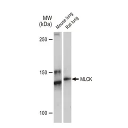 Anti-MLCK antibody [GT1296] used in Western Blot (WB). GTX03208