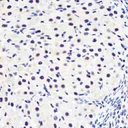 Anti-IKB alpha (phospho Ser36) antibody [GT1298] used in IHC (Paraffin sections) (IHC-P). GTX03210